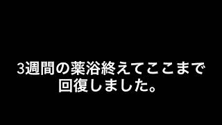 金魚飼育日記   白カビ、松かさ病   その後…