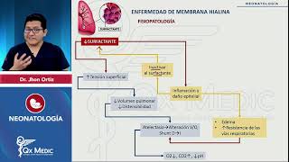 NEONATOLOGÍA - PROBLEMAS RESPIRATORIOS - 2024 QX MEDIC