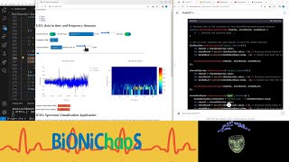 EEG Spectrogram: A Python Flask EEG Analysis Tool Development - Part 2