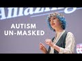 Autism Un-Masked | Kate Zarbatany | Amazing Brain Science Talks