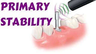 Primary Dental Implant Stability || Factor Affecting Primary Stability Dental implant lecture/Course