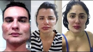 Falso médico deforma o rosto de mais de 30 pacientes e é procurado pela polícia do DF