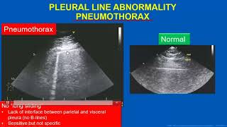 Point-of-Care Ultrasound (POCUS)- Mayo Clinic!