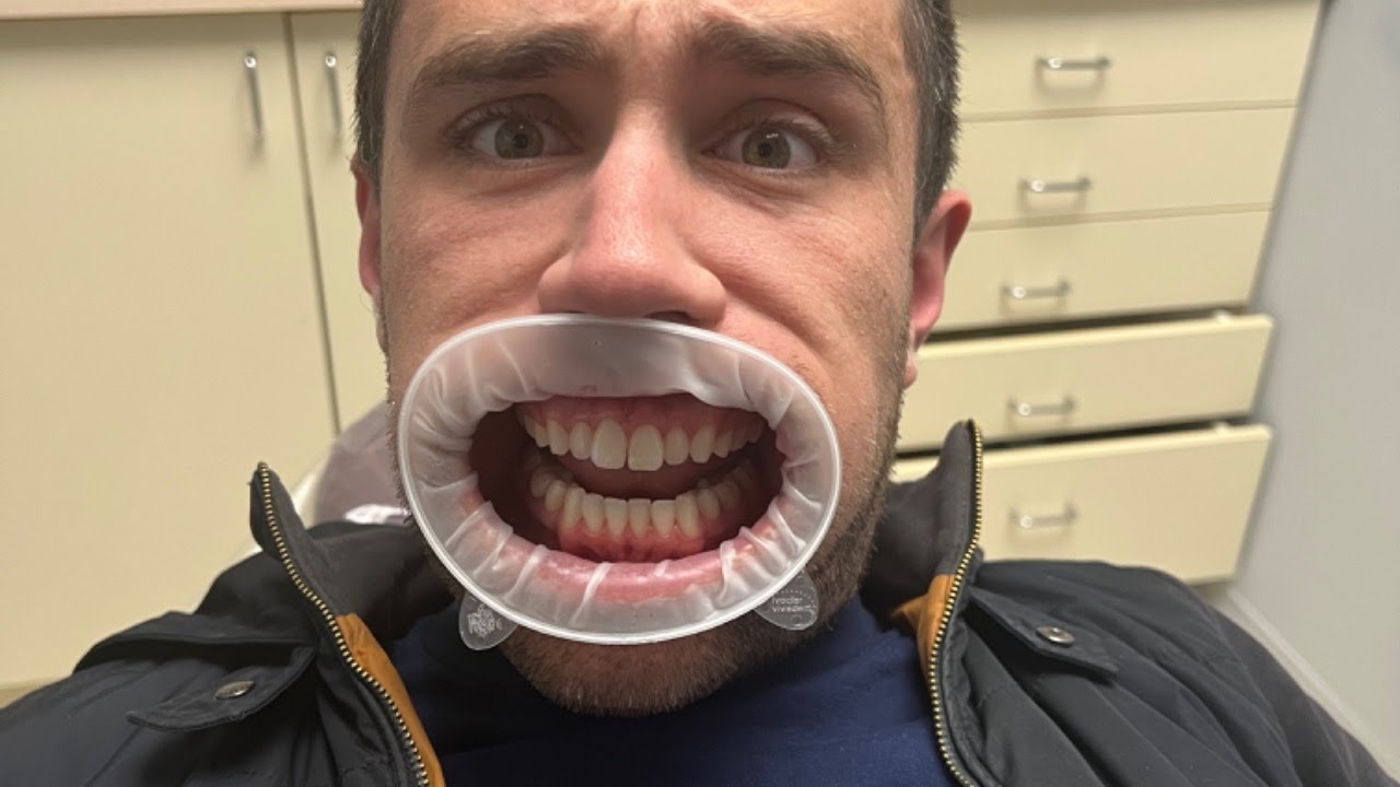 Jaw Dropping Stock Market Fall & Earnings