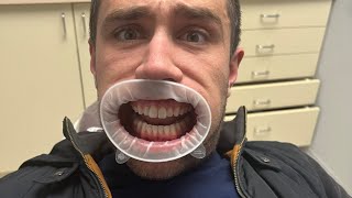 Jaw Dropping Stock Market Fall & Earnings