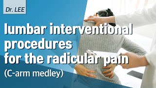 The technique of lumbar transforaminal injection for radicular pain : C arm medley series 1