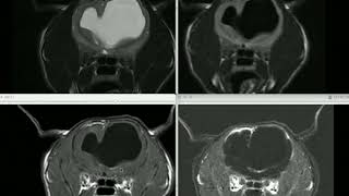 Neuroimaging Takeover - Week 6 (Imaging Findings)