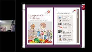 QI Community of Practice Webinar #4 - Heart Health