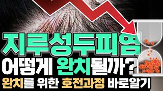 📌지루성두피염 호전과정 완벽정리 👉지루성두피염이 어떤 과정을 거치면서 치료되는지 정확히 알아야 합니다.