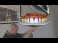 How to design 4 UNIT anterior case with CEREC/InLab