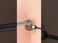 asmr navel stone belly button ring remove animation