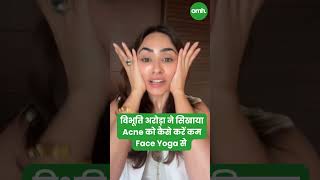 विभूति अरोड़ा ने सिखाया Acne को कैसे करें कम Face Yoga से I OnlyMyHealth