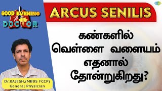 கண்களில் வெள்ளை வளையம் எதனால் தோன்றுகிறது? | EP 159 | Good Evening Doctor