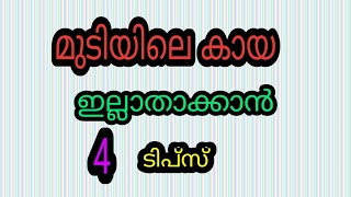 മുടിക്കായ ഇല്ലാതാക്കാൻ ഇതാ 4 ടിപ്സ് ... എങ്ങനെ ആണ് മുടിക്കായ ഉണ്ടാകുന്നത് എന്ന് അറിയേണ്ടേ ...