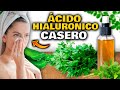 TÓNICO FACIAL CASERO de ÁCIDO HIALURÓNICO NATURAL | Elimina las Manchas, Arrugas, GRANOS y ACNÉ