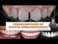 Smile Design Disadvantages & What to Expect? | Dr Arunkumar Pearls Dentistry | Dental Clinic India