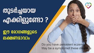 തുടര്‍ച്ചയായ എക്കിളുണ്ടോ? ഈ രോഗങ്ങളുടെ ലക്ഷണമാവാം .