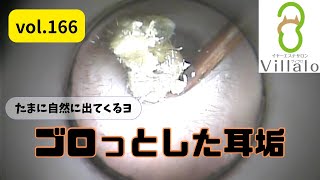 耳掃除 vol.166「ゴロっとした耳垢」(ear wax removal)イヤーエステサロンVillalo～ヴィラロ～