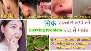 Piercing bumps गायब करने का आसान व घरेलू उपाय ll Home remedies for all piercing problems ll