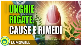 Unghie rigate: cause e rimedi