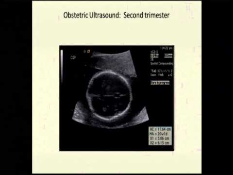 Ultrasonido Obstétrico Básico: Cómo Y Cuáles Imágenes Y Mediciones Dr ...