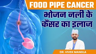 भोजन नली के कैंसर का इलाज | Esophageal Cancer | Treatment of Food Pipe Cancer | Dr. Vivel Mangla