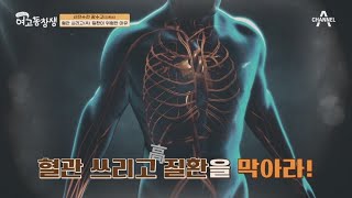 혈관 쓰리고 '고지혈증·고혈당·고혈압'! 혈관 쓰리고 질환이 위험한 이유 | 산전수전 여고동창생 79 회