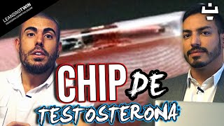 Chip de testosterona - implante de testosterona