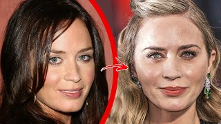 Top 10 Celebrities Who Went Overboard With Plastic Surgery