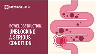 Bowel Obstruction: Unblocking A Serious Condition