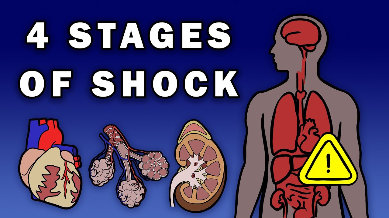 THE 4 STAGES OF SHOCK - YouTube