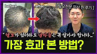 '이걸' 모르니까 머리가 계속 빠지는 겁니다… | 카이스트 출신 의사가 탈모에 진짜 효과 본 방법 5가지