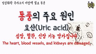 통풍의 원인 발견 / 요산 uric acid / uric acid 측정법