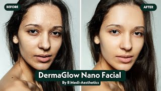 Ultimate Facial Treatment - Achieve Glowing Skin with DermaGlow Nano Facial by 8 Medi-Aesthetics