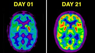 दिमाग को कमज़ोर करने वाली 5 चौकाने वाली आदतें | 5 Shocking Brain Damaging Habits.