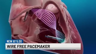 The new “no surgery, no wires” pacemaker
