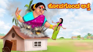 ಕೋಪಗೊಂಡ ಅತ್ತೆ Atte Vs Sose | Kannada stories | Kannada Kathegalu | Anamika TV Kannada