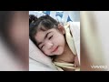 life story of my daughter with birth injury hie b 3y brain damage with hie story