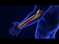 Broken Ulna Bone medical concept stock footage | stock video | Cinefootage