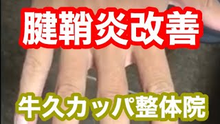 手首の痛みの改善【茨城県つくば市・牛久市の牛久カッパ整体院】