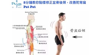 5分鐘教你點樣修正盆骨後傾，改善陀背扁Pat Pat