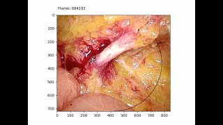 Laparoscopic Colorectal Surgical Instrument Recognition Using CNN–Based Instance Segmentation