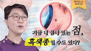 **흑색종** 지금 내 몸에 있는 점이.. 흑색종일수도 있다고요?! | 흑색종 1편 | 이지동안