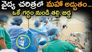 వైద్య చరిత్ర లో మహా అద్భుత...ఒకే గర్భం నుండి తల్లి, బిడ్డ | Miracle Happened in Medical History