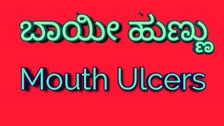 ಬಾಯಿ ಹುಣ್ಣು, ಅಲ್ಸರ್,mouth ulcer, ಕಾರಣ,ಲಕ್ಷಣ,ಚಿಕಿತ್ಸಾ ಪದ್ಧತಿ.