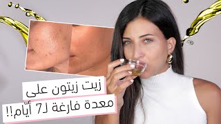 تناولتُ زيت الزيتون على معدة فارغة لمدّة 7 أيّام لأعالج حبوب الوجه والنتيجة أبهرَتني