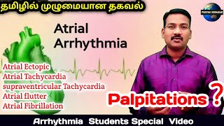 Atrial Arrhythmia in tamil | Atrial ectopic| supraventricular Tachycardia SVT |Flutter| fibrillation