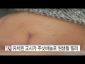 유치원 교사가 주삿바늘로 원생들 찔러 ytn yes top news