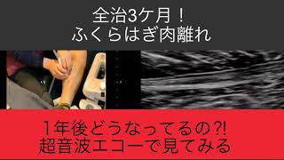 全治3ケ月の #ふくらはぎ肉離れ　1年後どうなってるか超音波エコーで確認した