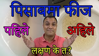 पिसाबमा फिज आउँदा के के लक्ष्यण आउँछ? कसरी थाहपाउने? Frothy urine - How to detect early? Dr. Diwakar